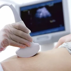 USG Level 1 pregnancy ultrasound sonography scan / NT-NB scan